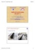 Bài giảng Thiết kế và xây dựng cầu 1: Chương 8 - TS. Nguyễn Ngọc Tuyển (P2)